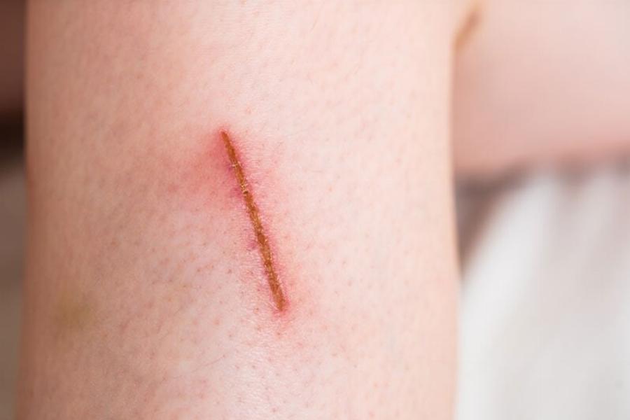 Γιατί οι γρατζουνιές της γάτας προκαλούν φαγούρα; 4 λόγοι σύμφωνα με έναν κτηνίατρο 